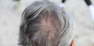 Lo stress fa venire i capelli bianchi?